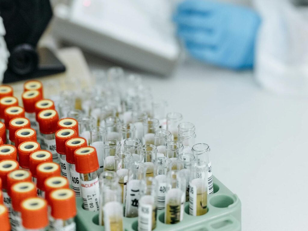 A laboratory scene featuring blood samples and a researcher using a pipette, ideal for medical research contexts.