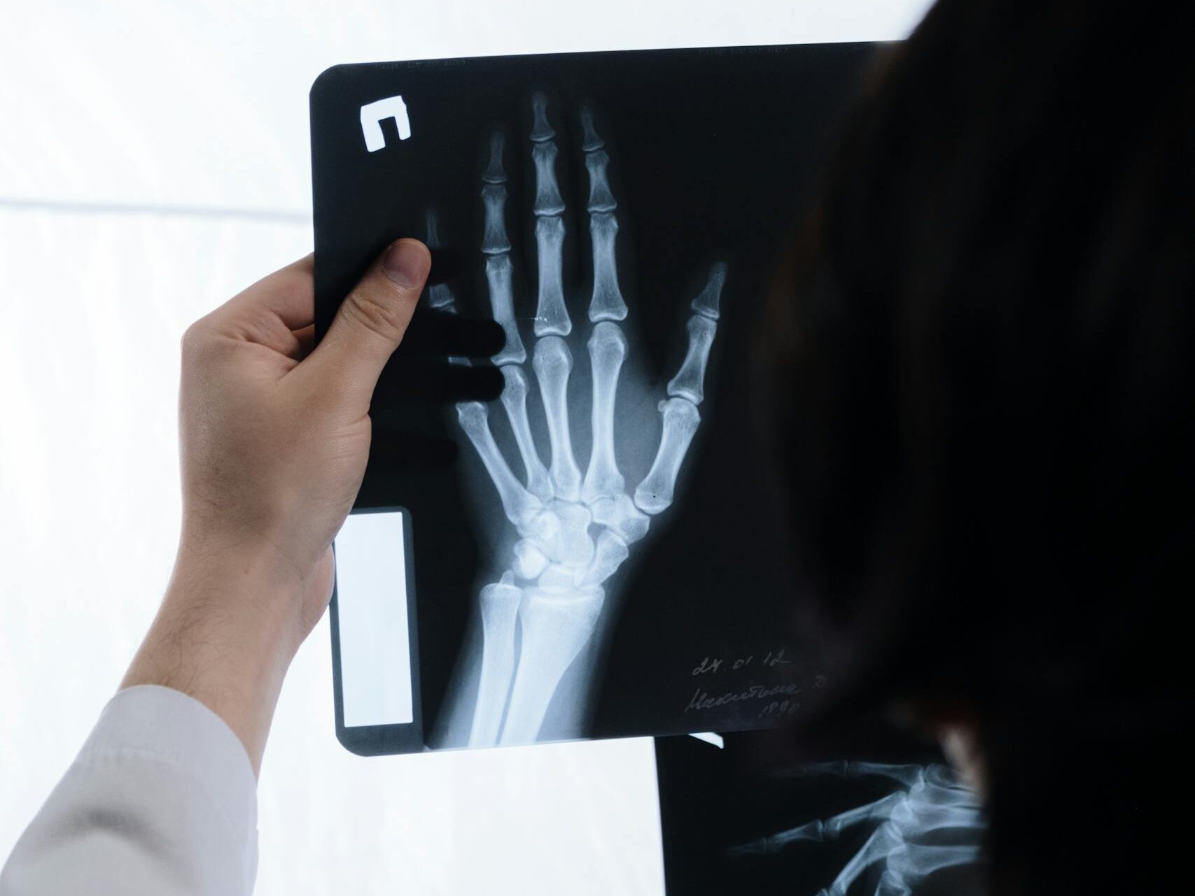 Doctor analyzing hand X-ray for signs of injury or bone health evaluation.